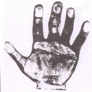The Hand of a Convicted Murderer