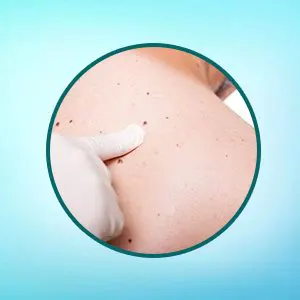 Mole on your body can reveal your Personality