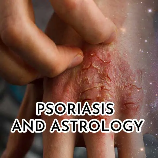 Psoriasis and astrology